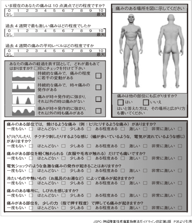 表4：日本語版Pain Detect